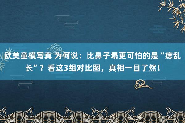 欧美童模写真 为何说：比鼻子塌更可怕的是“痣乱长”？看这3组对比图，真相一目了然！